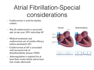 Defibrillation and cardioversion | PDF