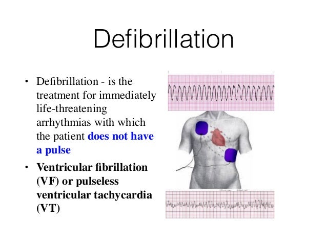 defibrillation