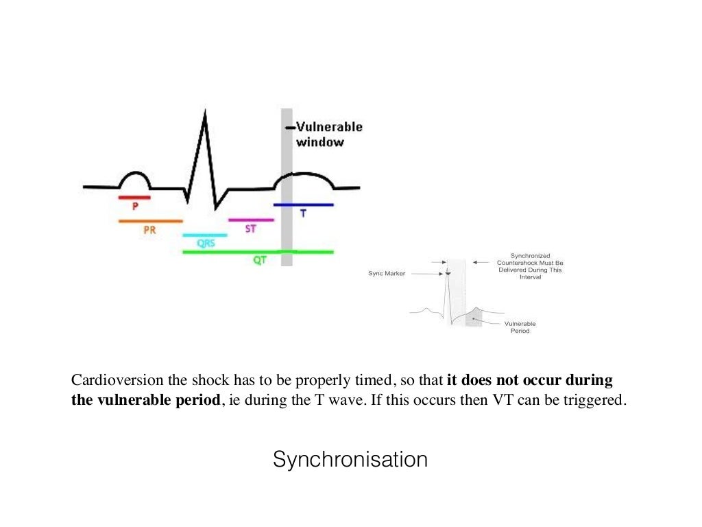 Defibrillation and cardioversion