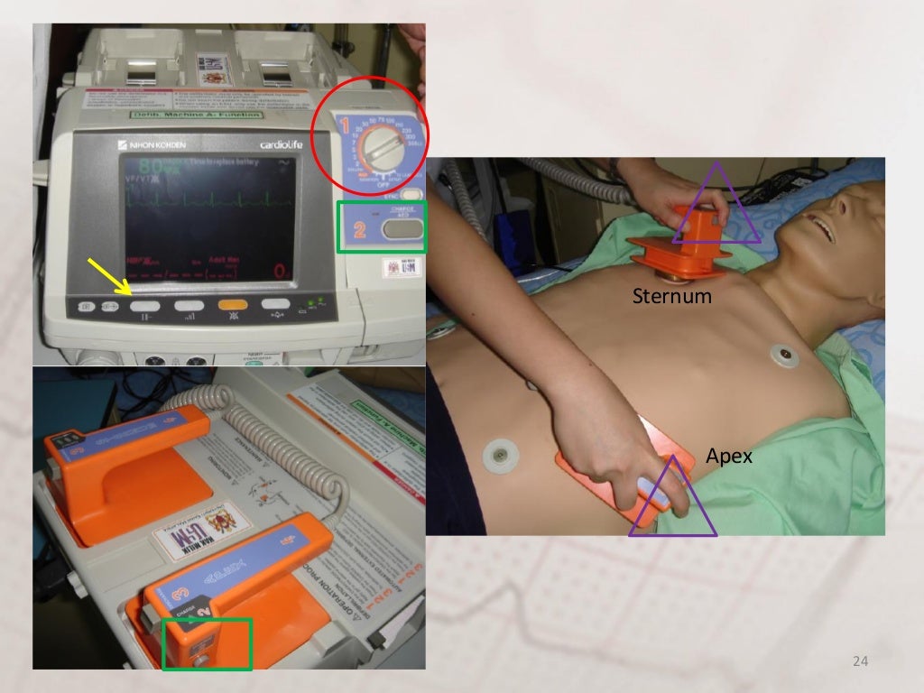 Defibrillator & cardioversion
