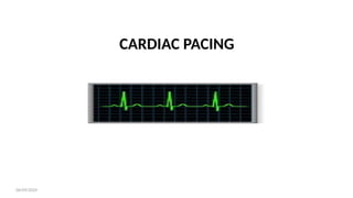 06/09/2024
CARDIAC PACING
 