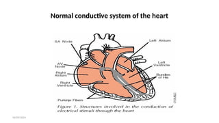 06/09/2024
Normal conductive system of the heart
 