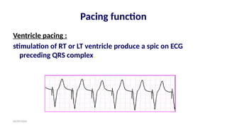 06/09/2024
Pacing function
Ventricle pacing :
stimulation of RT or LT ventricle produce a spic on ECG
preceding QRS complex.
 