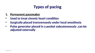 06/09/2024
Types of pacing
1. Permanent pacemaker
• Used to treat chronic heart condition
• Surgically placed transvenuosly under local anesthesia
• Pulse generator placed in a pocket subcutaneously ,can be
adjusted externally
 