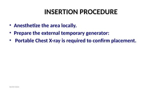 06/09/2024
INSERTION PROCEDURE
• Anesthetize the area locally.
• Prepare the external temporary generator:
• Portable Chest X-ray is required to confirm placement.
 