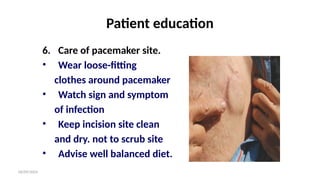 06/09/2024
Patient education
6. Care of pacemaker site.
• Wear loose-fitting
clothes around pacemaker
• Watch sign and symptom
of infection
• Keep incision site clean
and dry. not to scrub site
• Advise well balanced diet.
 