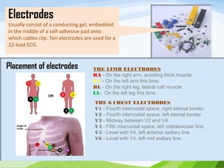 THE LIMB ELECTRODES
RA - On the right arm, avoiding thick muscle
LA – On the left arm this time.
RL - On the right leg, lateral calf muscle
LL- On the left leg this time.
THE 6 CHEST ELECTRODES
V1 - Fourth intercostal space, right sternal border.
V2 - Fourth intercostal space, left sternal border.
V3 - Midway between V2 and V4.
V4 - Fifth intercostal space, left midclavicular line.
V5 - Level with V4, left anterior axillary line.
V6 - Level with V4, left mid axillary line.
Electrodes
Usually consist of a conducting gel, embedded
in the middle of a self-adhesive pad onto
which cables clip. Ten electrodes are used for a
12-lead ECG.
Placement of electrodes
 
