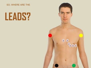 SO, WHERE ARE THE
LEADS?
 