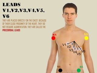 LEADS
V1,V2,V3,V4,V5,
V6
THEY ARE PLACED DIRECTLY ON THE CHEST. BECAUSE
OF THEIR CLOSE PROXIMITY OF THE HEART, THEY DO
NOT REQUIRE AUGMENTATION. THEY ARE CALLED THE
PRECORDIAL LEADS
RA LA
RL LL
V1
V2
V3
V4
V5
V6
 