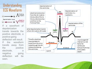 If a wavefront of
depolarization
travels towards the
positive electrode, a
positive-going
deflection will result. 
If the waveform
travels away from
the positive
electrode, a
negative going
deflection will be
seen. 
Understanding
ECG Waveform
 