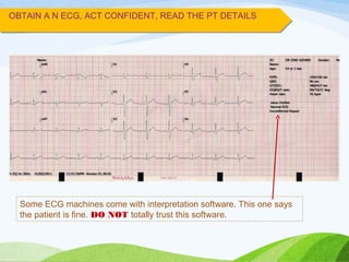 OBTAIN A N ECG, ACT CONFIDENT, READ THE PT DETAILS
Some ECG machines come with interpretation software. This one says
the patient is fine. DO NOT totally trust this software.
 