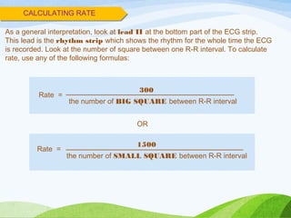 CALCULATING RATE
300
the number of BIG SQUARE between R-R interval
Rate =
As a general interpretation, look at lead II at the bottom part of the ECG strip.
This lead is the rhythm strip which shows the rhythm for the whole time the ECG
is recorded. Look at the number of square between one R-R interval. To calculate
rate, use any of the following formulas:
1500
the number of SMALL SQUARE between R-R interval
OR
Rate =
 