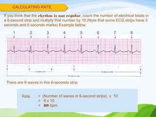 If you think that the rhythm is not regular, count the number of electrical beats in
a 6-second strip and multiply that number by 10.(Note that some ECG strips have 3
seconds and 6 seconds marks) Example below:
CALCULATING RATE
1 2 3 4 5 6 7 8
= (Number of waves in 6-second strips) x 10
= 8 x 10
= 80 bpm
Rate
There are 8 waves in this 6-seconds strip.
 