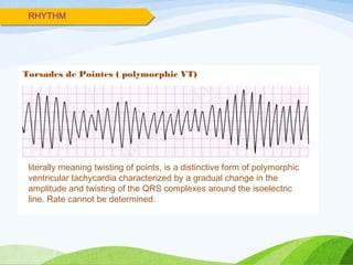 RHYTHM
Torsades de Pointes ( polymorphic VT)
literally meaning twisting of points, is a distinctive form of polymorphic
ventricular tachycardia characterized by a gradual change in the
amplitude and twisting of the QRS complexes around the isoelectric
line. Rate cannot be determined.
 