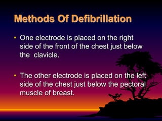 Methods Of Defibrillation
• One electrode is placed on the right
side of the front of the chest just below
the clavicle.
• The other electrode is placed on the left
side of the chest just below the pectoral
muscle of breast.
 