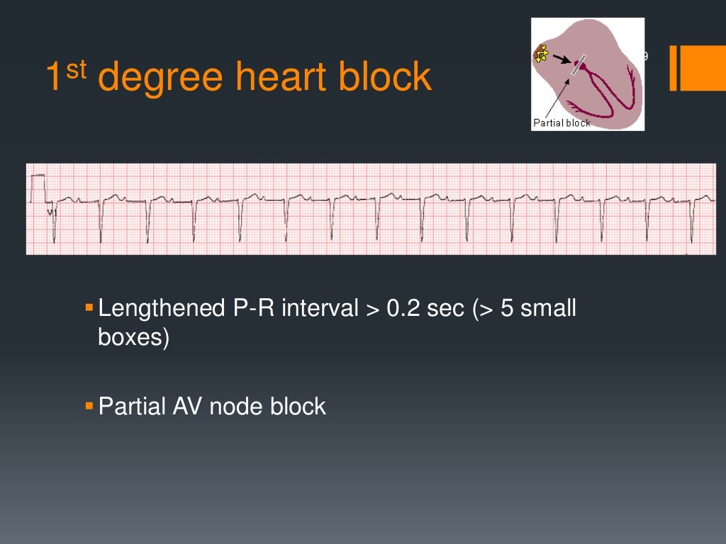 Defibrillation, cardioversion and pacing