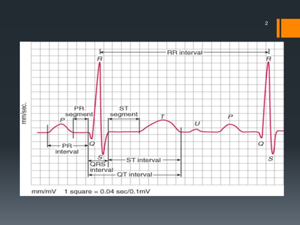 Defibrillation, cardioversion and pacing