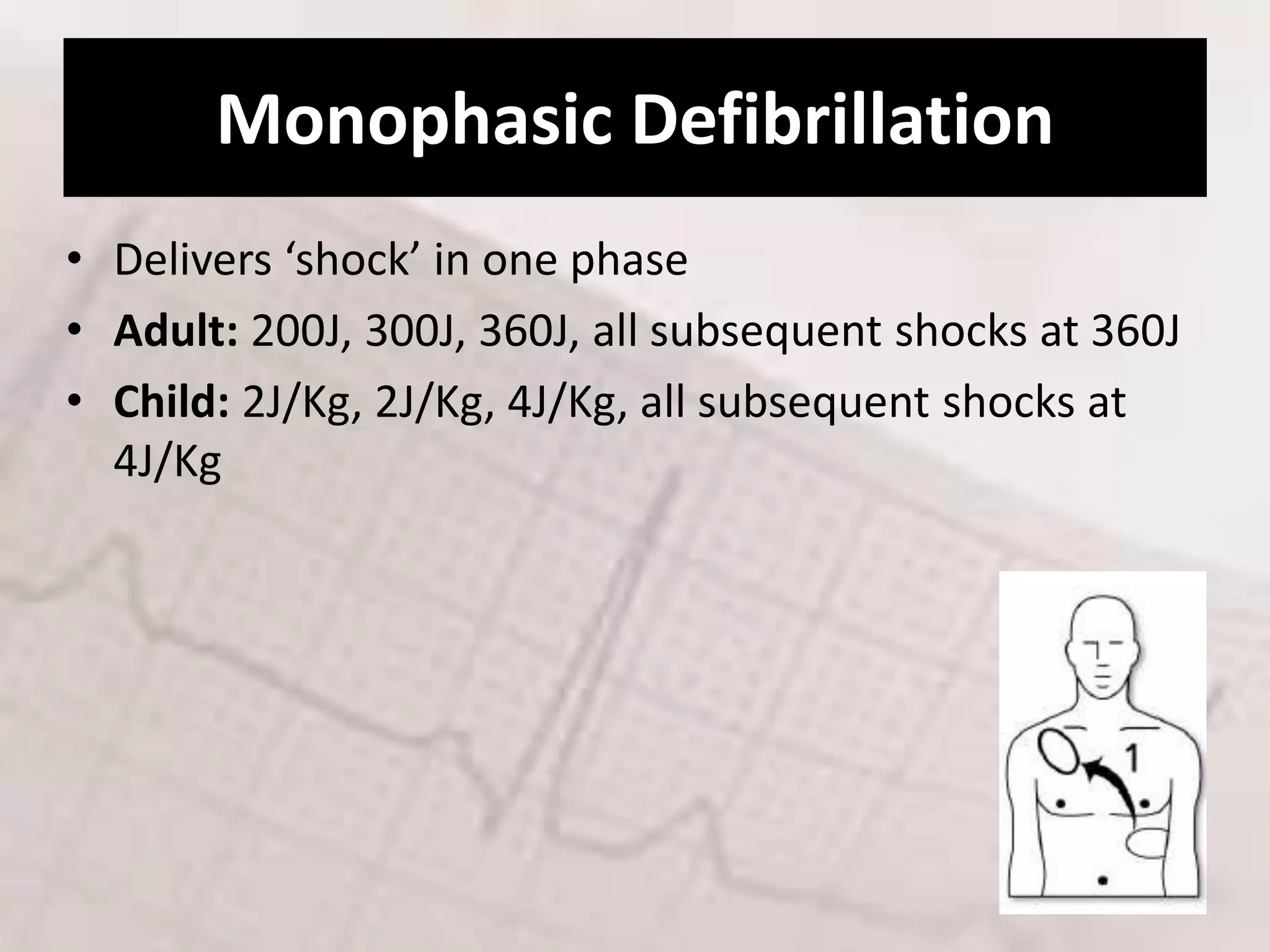 Cardioversion 100j Defibrillation & cardioversion by DJ | PPTX