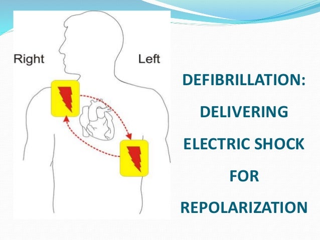 Life After A Shock Post Defibrillation Actions You Must Know - 8e7wnrd