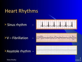 Heart Rhythms 23/04/10 Sinus rhythm   - V – Fibrillation   - Asystole rhythm  - Shane Bradley 