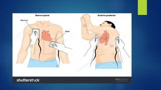Defib Powerpoint Defibrillator | PPTX