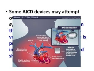 DEFIBRILLATOR | PPTX