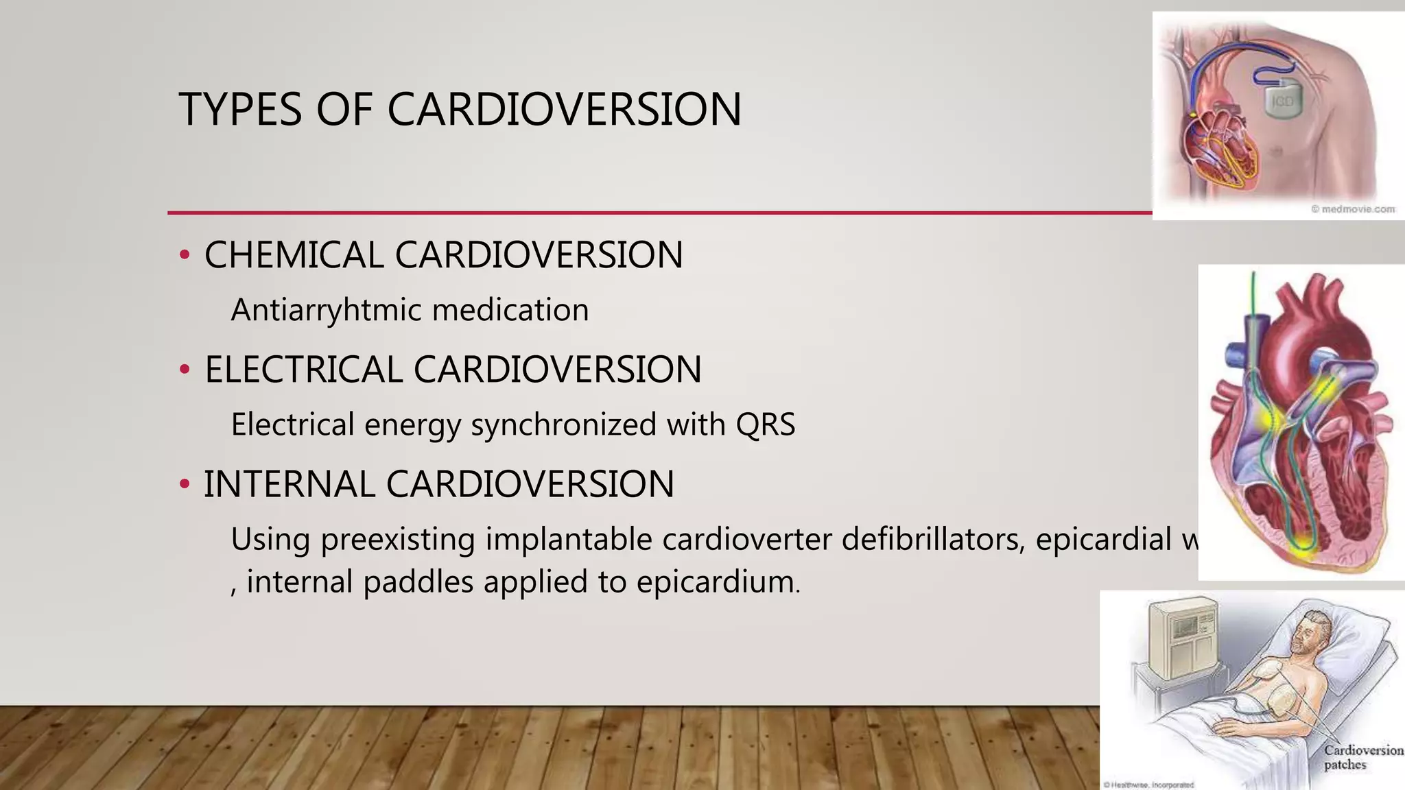 TYPES OF CARDIOVERSION
• CHEMICAL CARDIOVERSION
Antiarryhtmic medication
• ELECTRICAL CARDIOVERSION
Electrical energy synchronized with QRS
• INTERNAL CARDIOVERSION
Using preexisting implantable cardioverter defibrillators, epicardial wires
, internal paddles applied to epicardium.
 