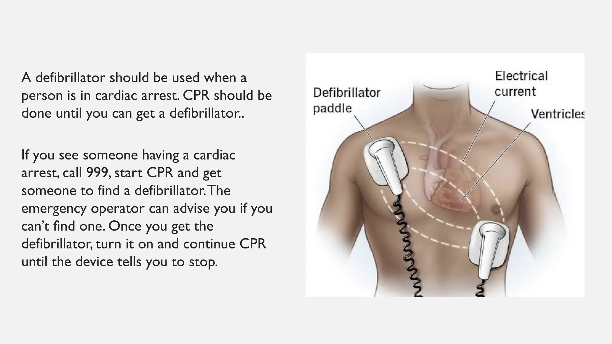 A defibrillator should be used when a
person is in cardiac arrest. CPR should be
done until you can get a defibrillator..
If you see someone having a cardiac
arrest, call 999, start CPR and get
someone to find a defibrillator.The
emergency operator can advise you if you
can’t find one. Once you get the
defibrillator, turn it on and continue CPR
until the device tells you to stop.
 
