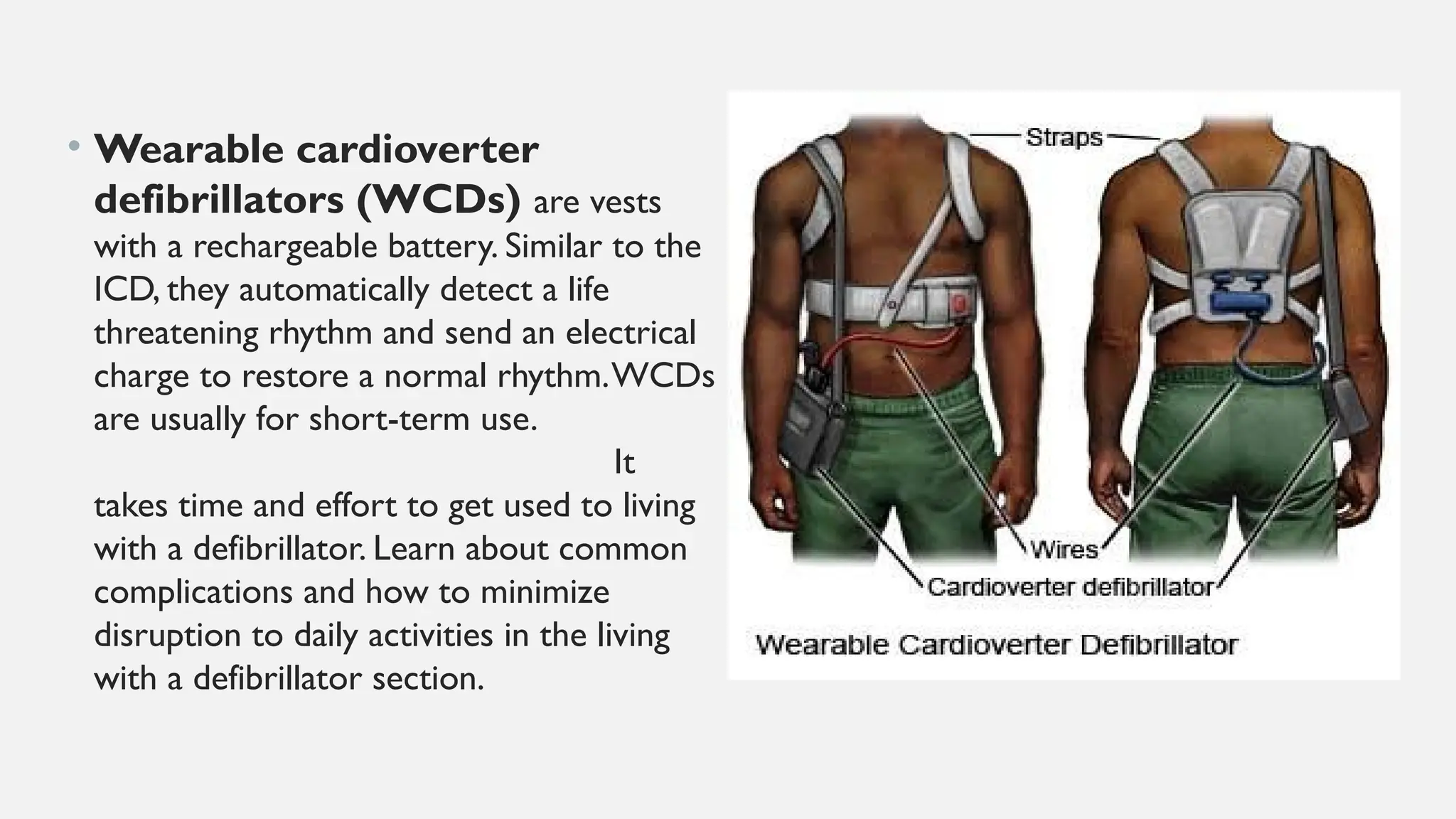 • Wearable cardioverter
defibrillators (WCDs) are vests
with a rechargeable battery. Similar to the
ICD, they automatically detect a life
threatening rhythm and send an electrical
charge to restore a normal rhythm.WCDs
are usually for short-term use.
It
takes time and effort to get used to living
with a defibrillator. Learn about common
complications and how to minimize
disruption to daily activities in the living
with a defibrillator section.
 