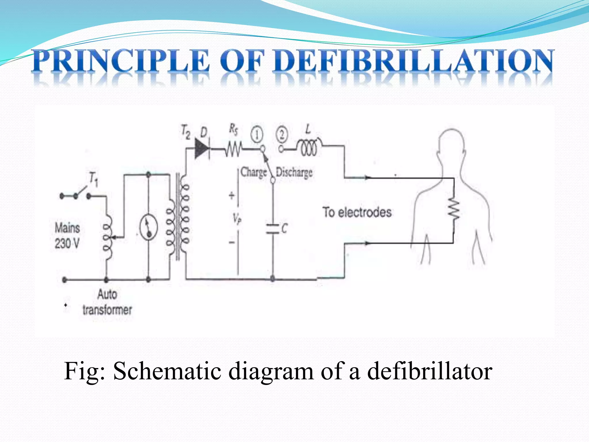 Fig: Schematic diagram of a defibrillator
 