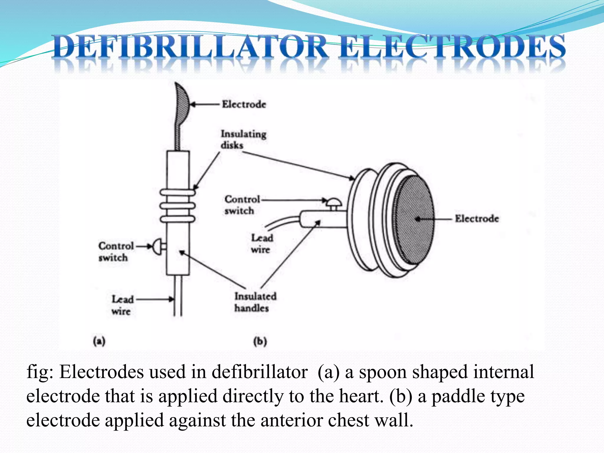 fig: Electrodes used in defibrillator (a) a spoon shaped internal
electrode that is applied directly to the heart. (b) a paddle type
electrode applied against the anterior chest wall.
 