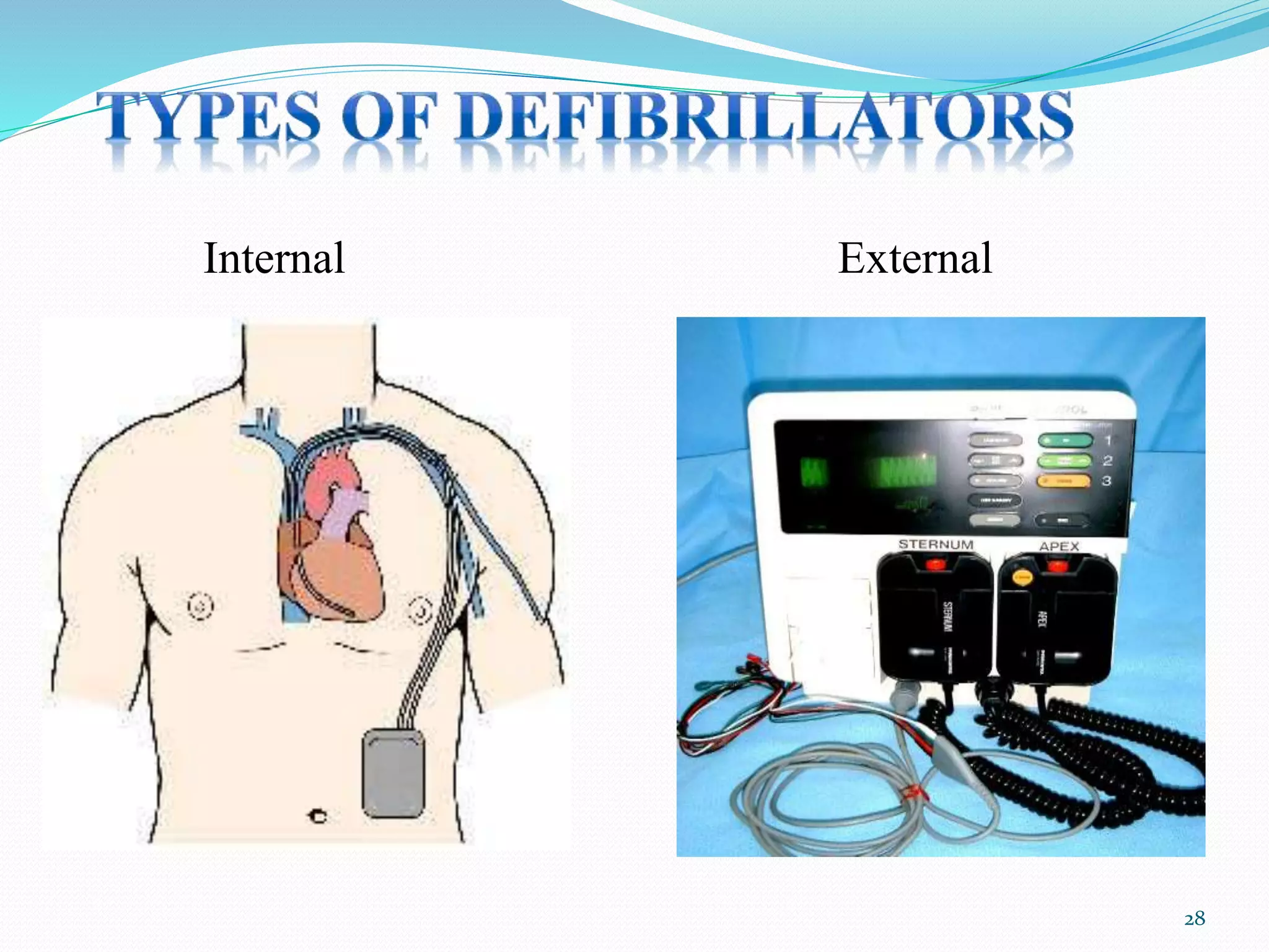Internal External
28
 
