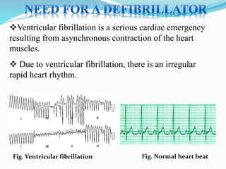 Vi Fib Defibrillatorppt 131028115457-phpapp01 | PPTX