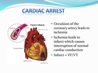  Occulsion of the

coronary artery leads to
ischemia
 Ischemia leads to
infarct which causes
interruption of normal
cardiac conduction
 Infarct = VF/VT

 