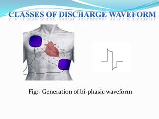 Fig:- Generation of bi-phasic waveform

 