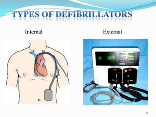 Internal

External

28

 