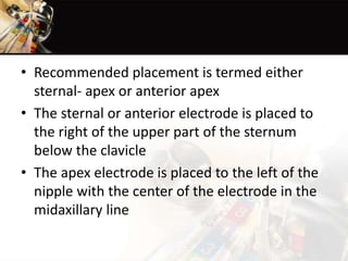 • Recommended placement is termed either
sternal- apex or anterior apex
• The sternal or anterior electrode is placed to
the right of the upper part of the sternum
below the clavicle
• The apex electrode is placed to the left of the
nipple with the center of the electrode in the
midaxillary line
 