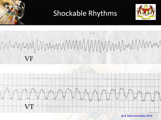Shockable Rhythms




VF




VT
                         ALS Subcommittee 2010
 