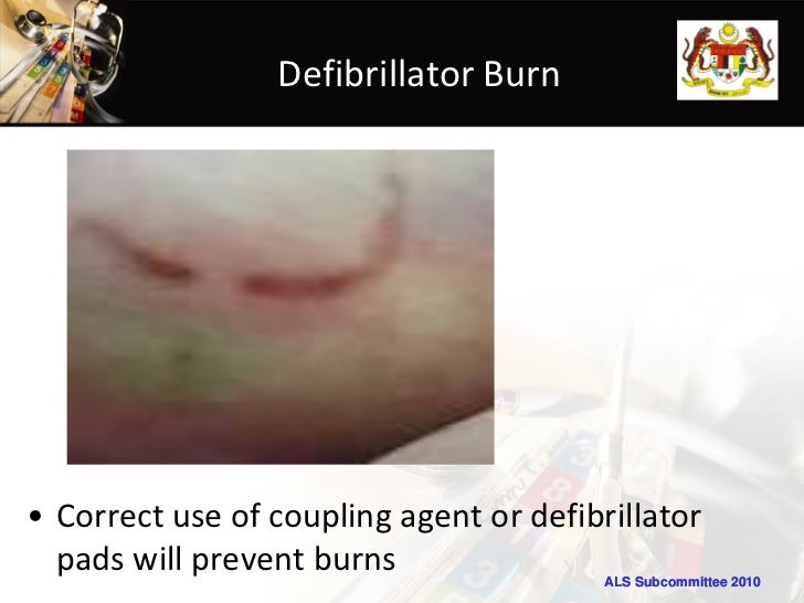 Defib skillstation22122011edited