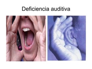 Deficiencia auditiva 