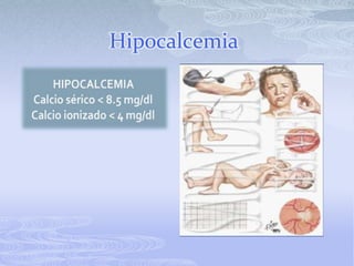 Hipocalcemia