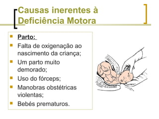 Causas inerentes à
Deficiência Motora
 Parto:
 Falta de oxigenação ao
nascimento da criança;
 Um parto muito
demorado;
 Uso do fórceps;
 Manobras obstétricas
violentas;
 Bebés prematuros.
 