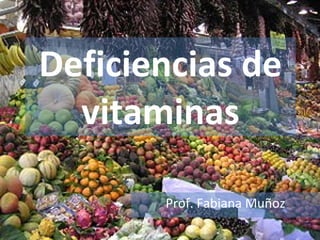 Deficiencias de vitaminas Prof. Fabiana Muñoz 