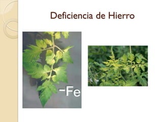 Deficiencia de Hierro
 