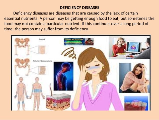 protein diet deficiency disease protein diet deficiency disease