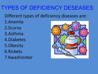 TYPES OF DEFICIENCY DESEASES: 
Different types of deficiency diseases are: 
1.Anemia 
2.Scurvy 
3.Asthma 
4.Diabetes 
5.Obesity 
6.Rickets 
7.Kwashiorkor 
 