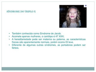 SÍNDROME DO TRIPLO X
• Também conhecida como Síndrome de Jacob.
• Acomete apenas mulheres, o cariótipo é 47 XXX;
• A hereditariedade pode ser materna ou paterna, as características
físicas são aparentemente normais, porém ocorre DI leve.
• Diferente de algumas outras síndromes, as portadoras podem ser
férteis.
 