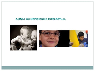 ADNM ou Deficiência Intelectual
 