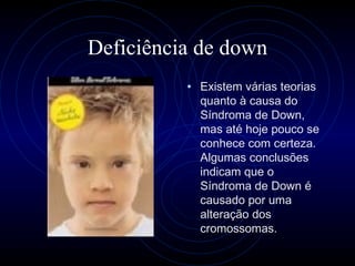 Deficiência de down Existem várias teorias quanto à causa do Síndroma de Down, mas até hoje pouco se conhece com certeza. Algumas conclusões indicam que o Síndroma de Down é causado por uma alteração dos cromossomas.  