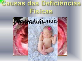 Pre-nataisPeri-nataisPós-nataisPré-gestacionais
 